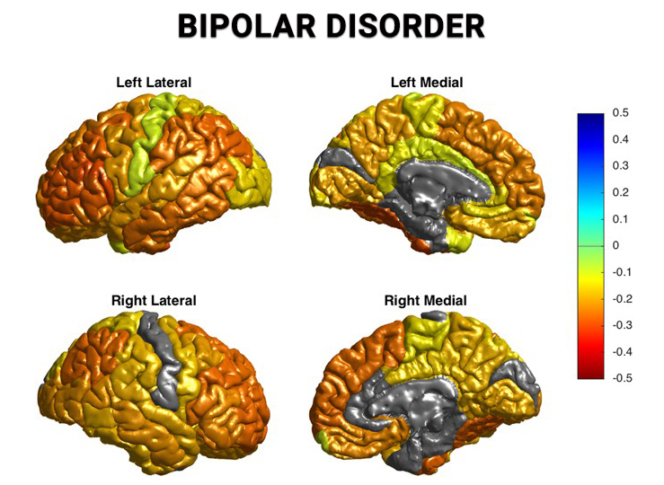 Bipolar Disorder