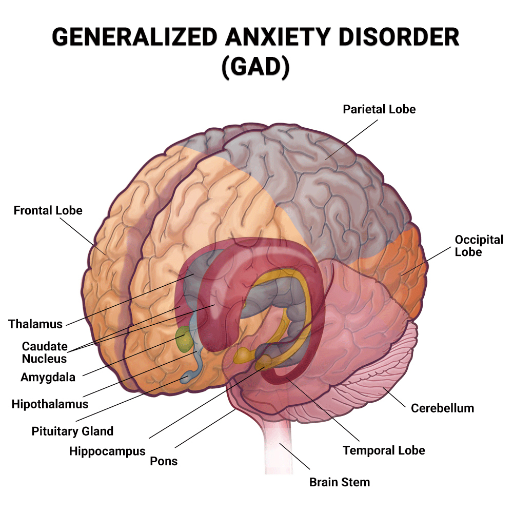 anxiety disorder brain