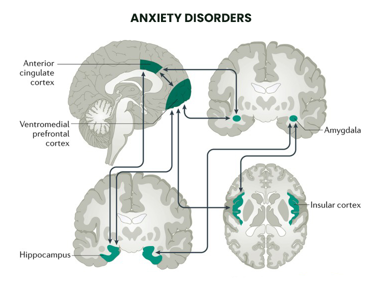 Anxiety Disorders