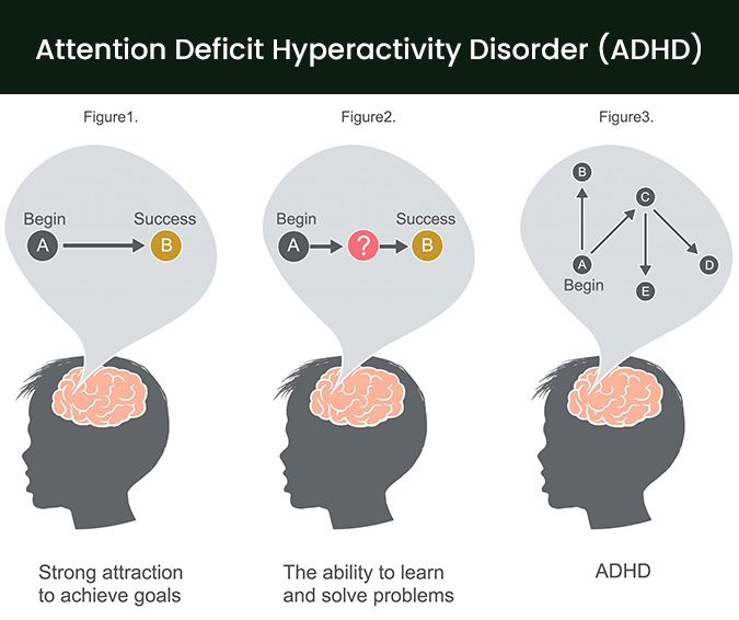 Attention Deficit Hyperactivity Disorder